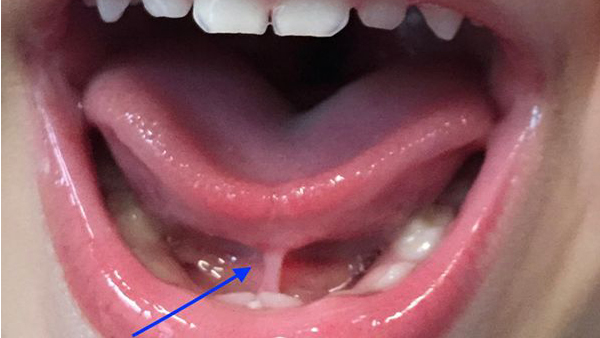 dentist for kids