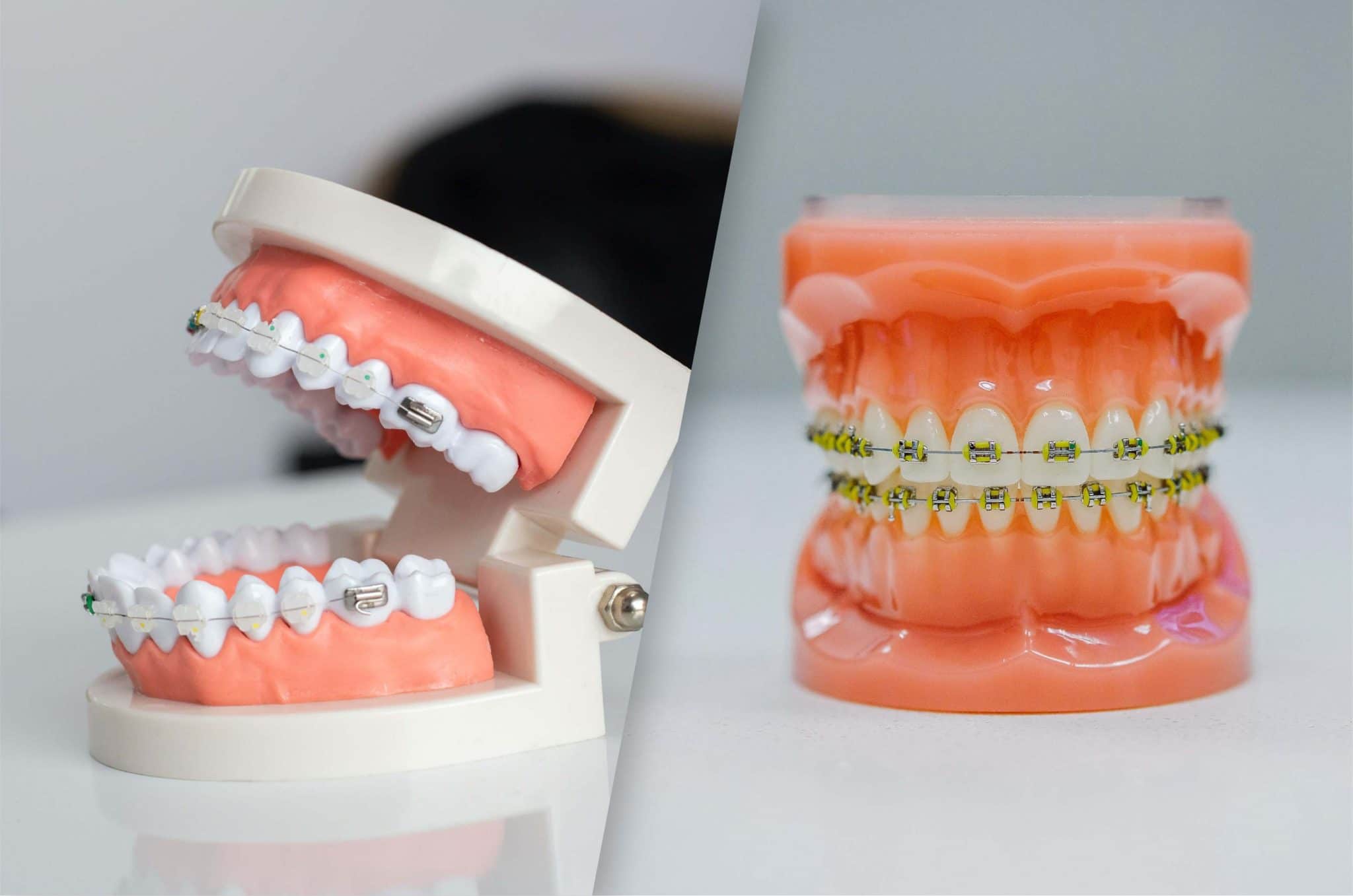 dentist for kids
