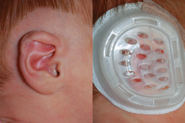 My Pedia Clinic - Ear Molding Banner