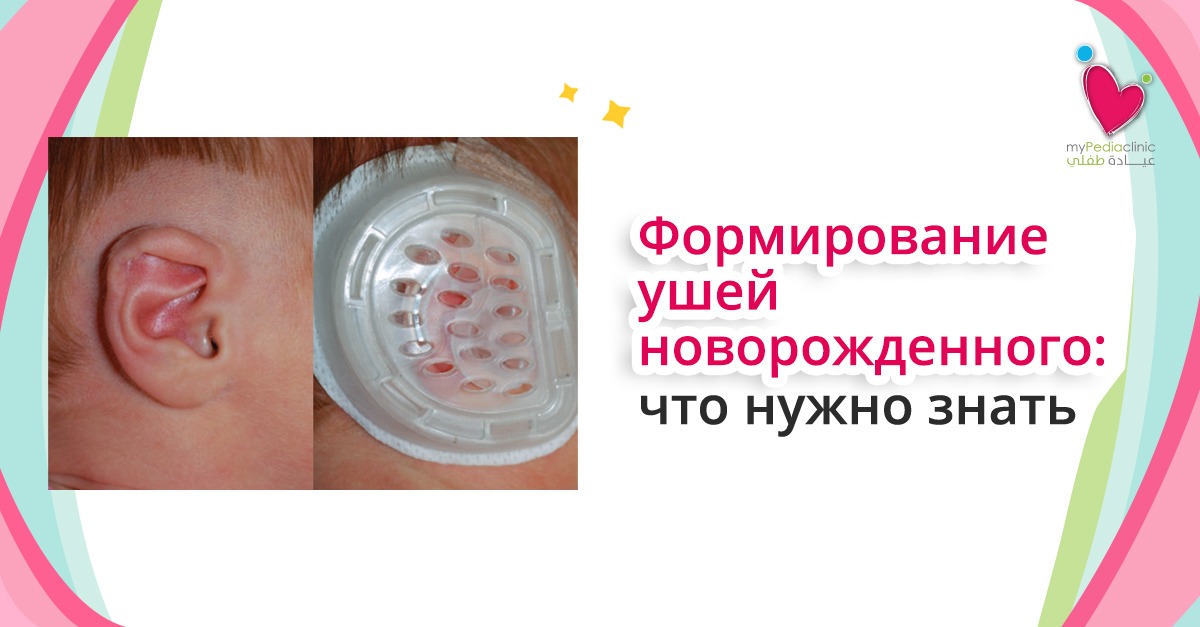 Ear Molding