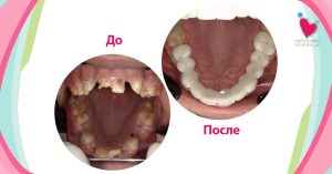 Teeth